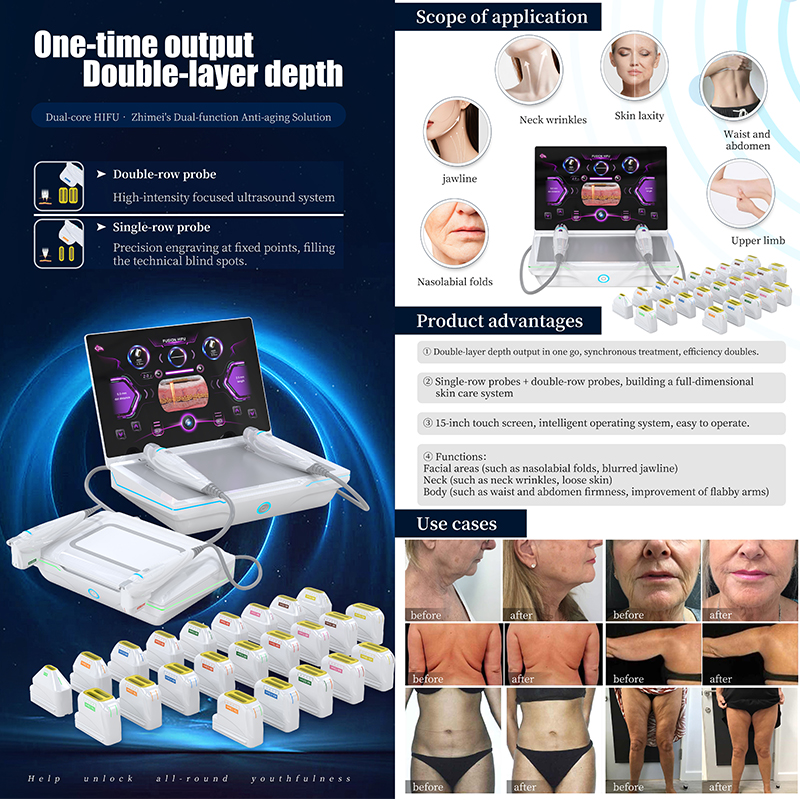 High-intensity Fusion HIFU Dual Handles 2.0mm to 18mm SMAS Layers Facial and Body Anti-aging and Contouring Beauty Device